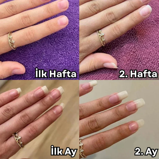 1Alana 1 Bedava! Tırnak Serumu